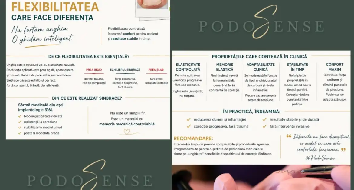 Flexibilitatea SinBrace – cheia corecției reale a unghiei