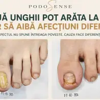 Două unghii pot arăta identic. Dar cauza poate fi complet diferită